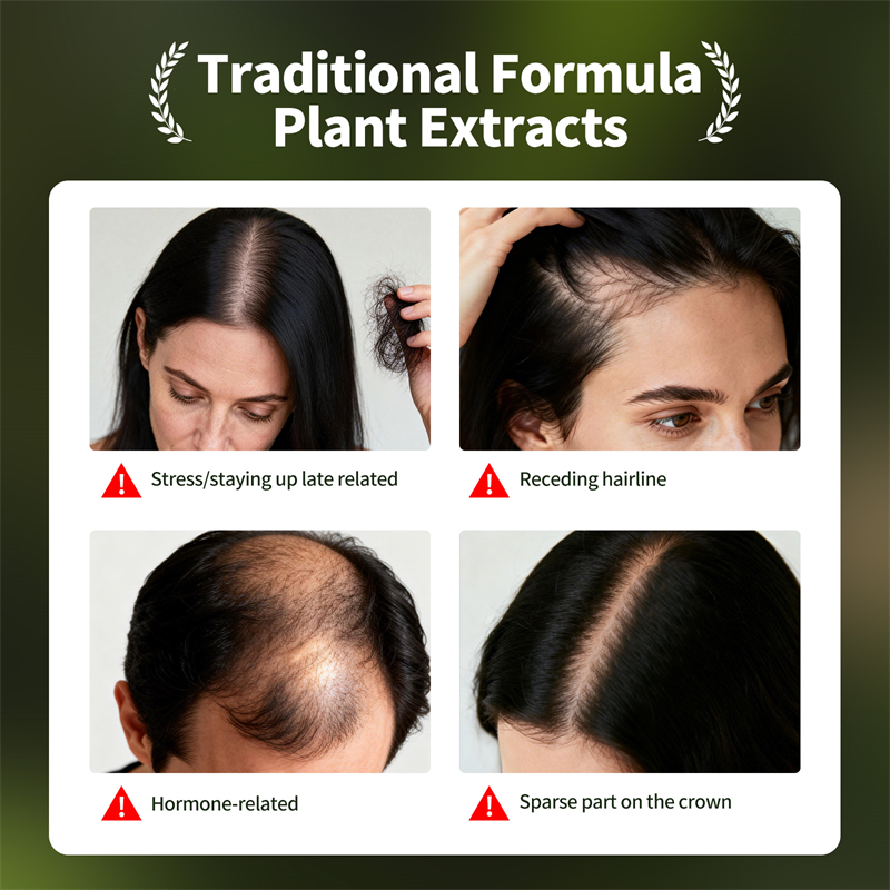 Natürliches Haarwachstumsset U – Ingrown Hair Serum Bewertung und Preis
