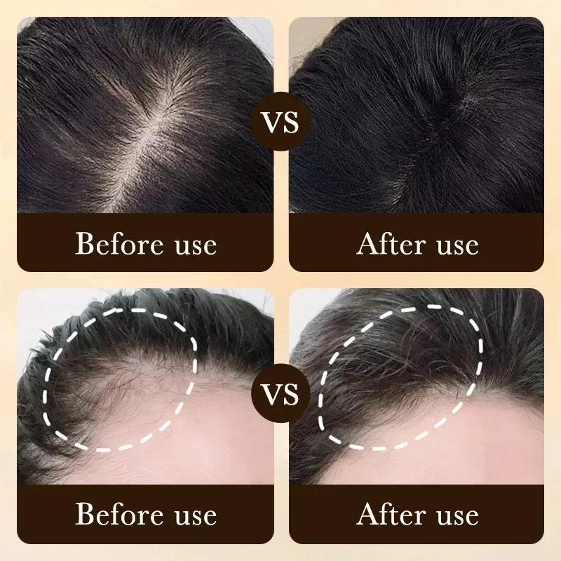 Biotin Schnelles Haarwuchsöl P – Ingrown Hair Serum Bewertung und Preis